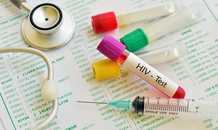 Cepiva proti covidu-19 ne vsebujejo HIV  