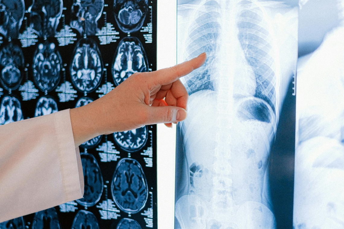 UKC Maribor uvedel nadzor nad radiologom z rekordnim številom preiskav